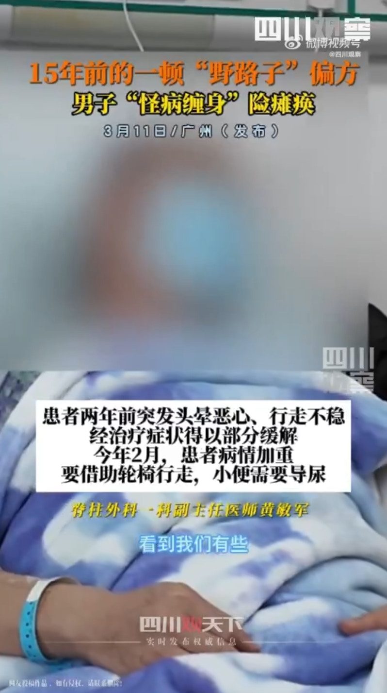 廣州一名55歲的郭先生今年2月開始需仰賴輪椅行動，小便需導尿，在此之前已有頭暈嘔吐的症狀。經醫生診斷，因郭先生15年前聽信偏方「吞蛇膽、喝蛇藥酒」，導致脊髓被「曼氏裂頭絛蟲」感染，甚至差點癱瘓。（微博＠四川觀察）