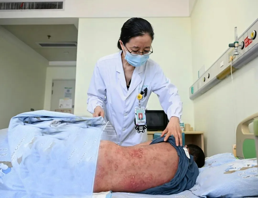 武漢兒童醫院風濕免疫科主任醫師丁艷查看患兒的情況。（極目新聞）