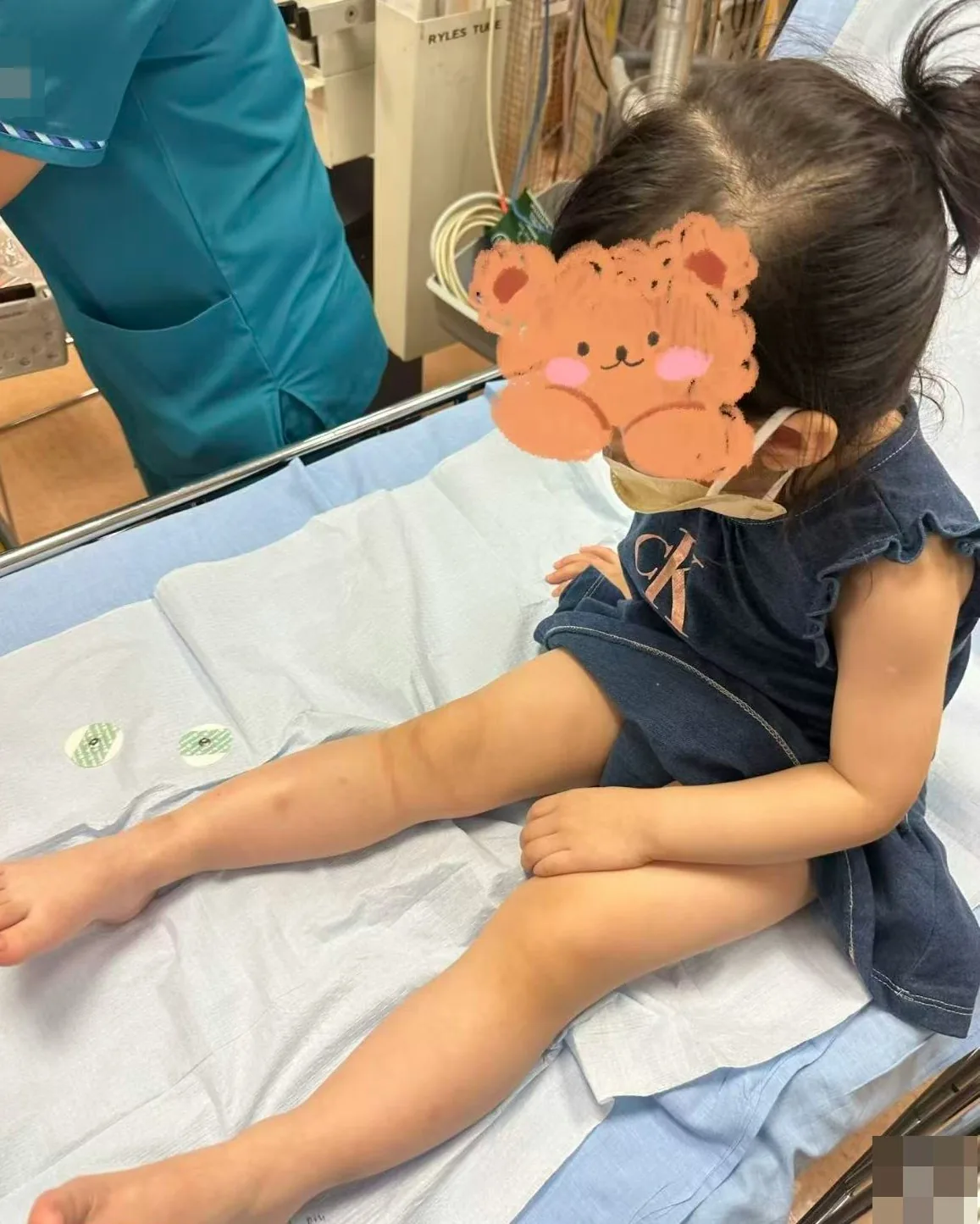 中国2岁女童新加坡行步道遭蛇咬伤 幸属无毒蛇母吁家长小心 2 中國2歲女童新加坡逛博物館遭蛇咬傷。(社交平台截圖)
