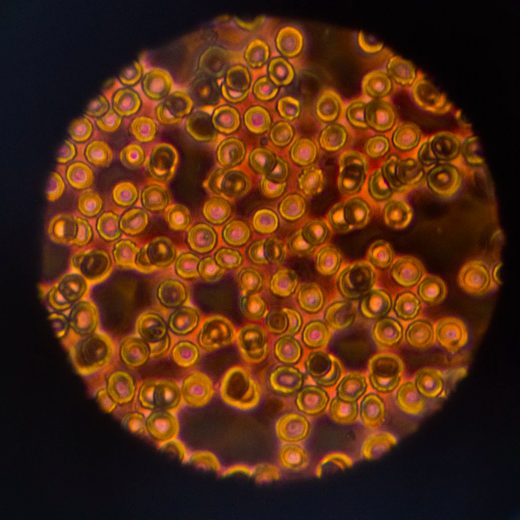 搞笑诺贝尔奖 蟑螂奶热量高、富人爱偷糖等猎奇研究获奖 2 Structure of a heterogeneous, glycosylated, lipid-bound, in vivo-grown protein crystal at atomic resolution from the viviparous cockroach Diploptera punctata