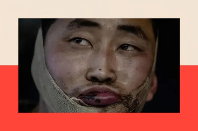 乌克兰总统弗拉基米尔·泽连斯基发布的一张照片，据称显示两名被俘朝鲜士兵中的其中一人。