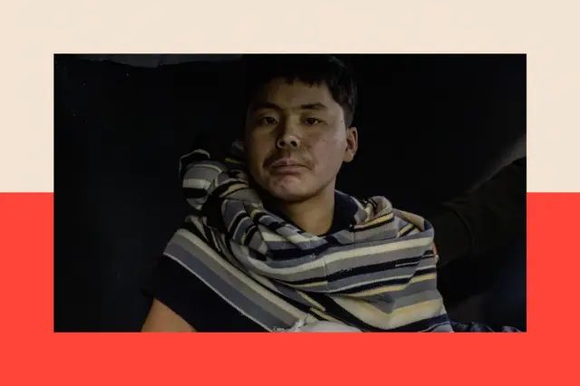 图片显示一名男子望向镜头。他的毛衣被拉起一半覆盖在躯干上，双手裹着绷带。