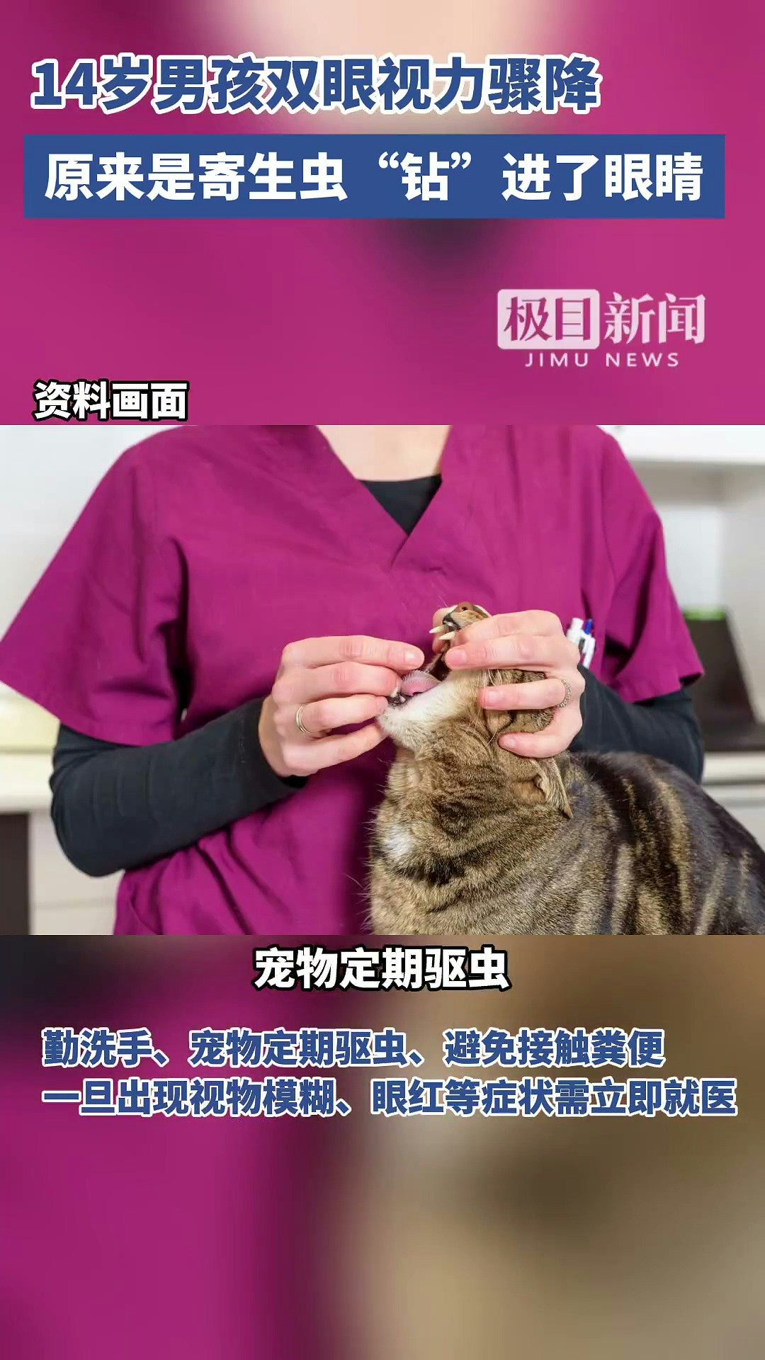 14歲的湖北京山男孩小宇（化名），雙眼視力已降至右眼0.02.左眼0.1，近乎失明。經檢查，他被確診為眼弓蛔蟲感染，眼底已造成不可逆損傷，險些徹底失明。據了解，小宇常與家中的土貓土狗同吃同睡。（截取自微博@極目新聞）