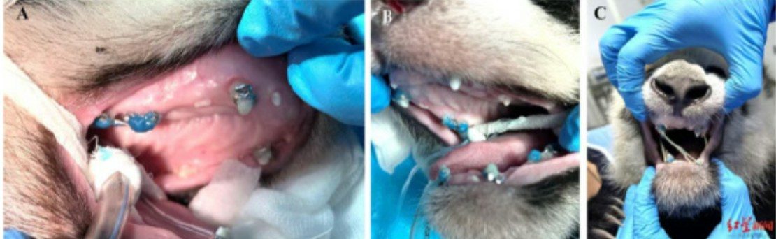 全球首例!成都歪脸大熊猫北侠「箍牙」 半年恢复健康不再漏奶 3 醫生在黏接矯治器後,為「北俠」套上3根正畸彈性橡皮圈,原理與人類戴牙套極為相似。(紅星新聞)