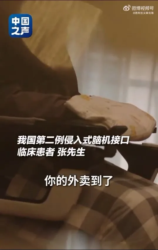 【延伸閲讀】中國第二例侵入式腦機接口臨牀患者張先生，分享手術後生活，僅憑意念，就能操控輪椅在公園散步，亦可指揮機械狗取回外賣。（中國之聲）