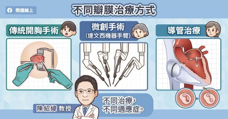心脏瓣膜没症状能拖吗?2025欧洲治疗新指引:二尖瓣及早修补、TAVI放宽至70岁 2 不同瓣膜治療方式