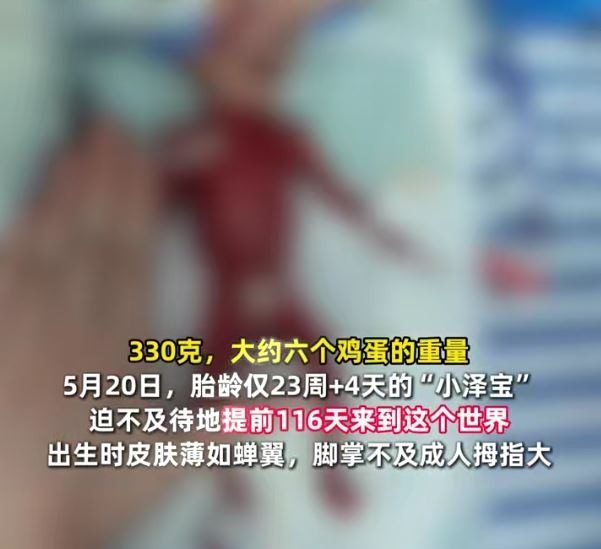 5月20日，胎齡僅23周+4天的「小澤寶」迫不及待地提前116天來到這個世界。（微信視頻號@深圳晚報）