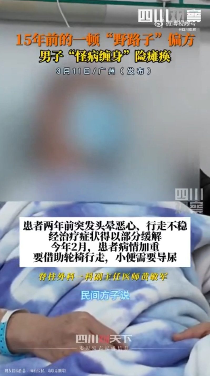 廣州一名55歲的郭先生今年2月開始需仰賴輪椅行動，小便需導尿，在此之前已有頭暈嘔吐的症狀。經醫生診斷，因郭先生15年前聽信偏方「吞蛇膽、喝蛇藥酒」，導致脊髓被「曼氏裂頭絛蟲」感染，甚至差點癱瘓。（微博＠四川觀察）