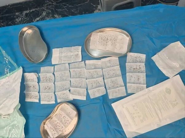 入秋注意!男子散步遭蜂群围攻 全身千根毒刺 医生拔刺近3小时 3 經精心救治,患者病情逐步趨於平穩,腫脹消退,各項異常指標逐步恢復,最終順利康復出院。(南方新聞網)
