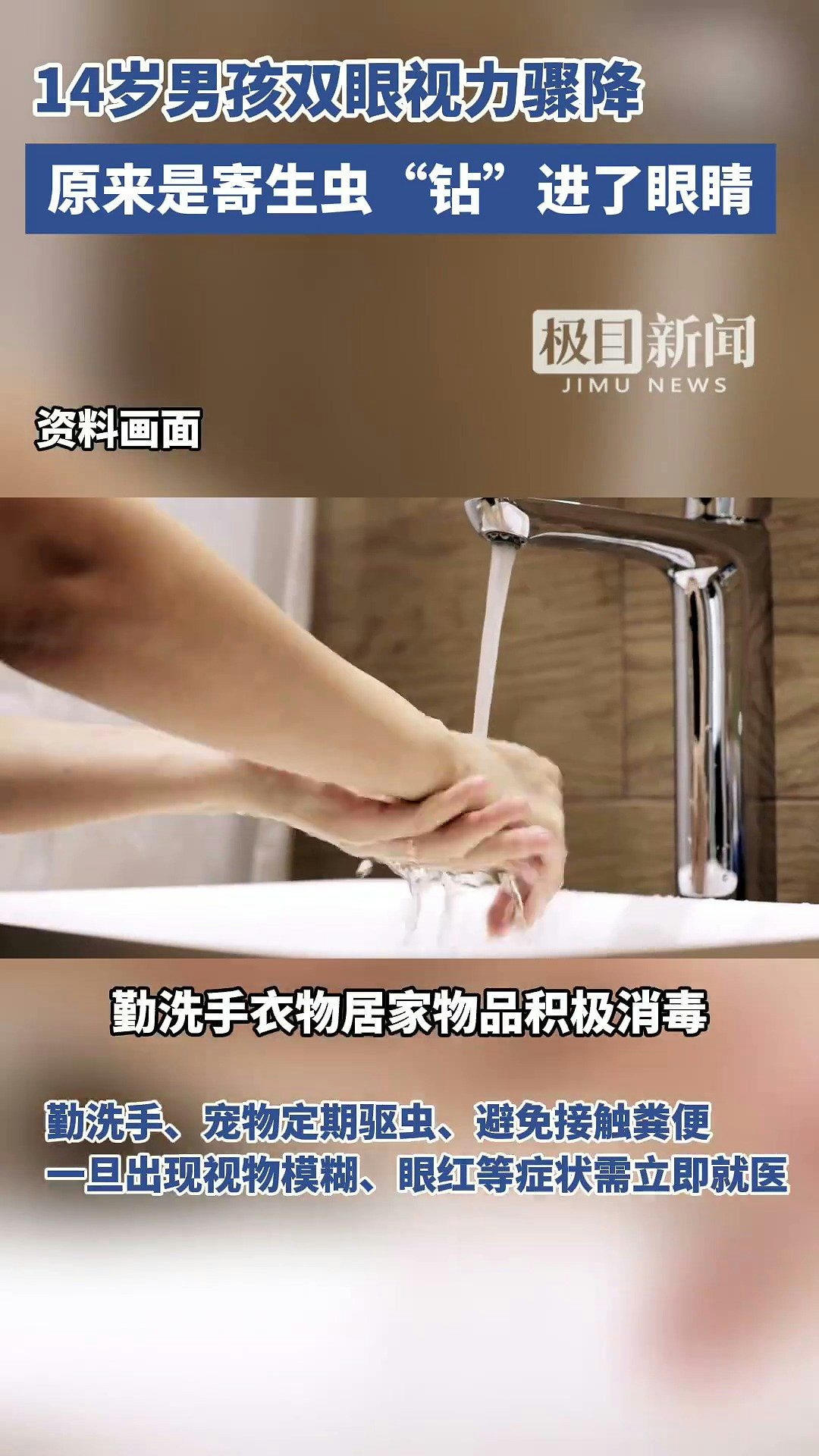 14歲的湖北京山男孩小宇（化名），雙眼視力已降至右眼0.02.左眼0.1，近乎失明。經檢查，他被確診為眼弓蛔蟲感染，眼底已造成不可逆損傷，險些徹底失明。據了解，小宇常與家中的土貓土狗同吃同睡。（截取自微博@極目新聞）