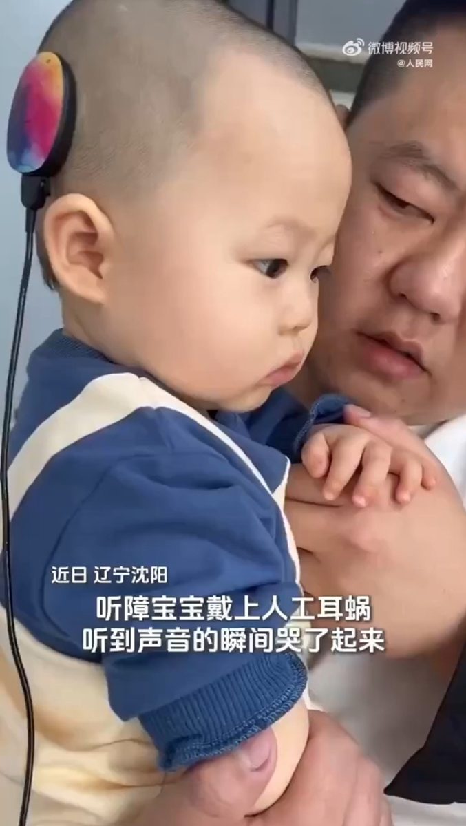 【延伸閲讀】遼寧瀋陽一年幼的聽障寶寶近日首次戴上了人工耳蝸，而這也是他第一次聽見外界清楚的聲音。寶寶的媽媽在一旁喊了聲「兒子」後，孩子被嚇哭了。（微博影片截圖）