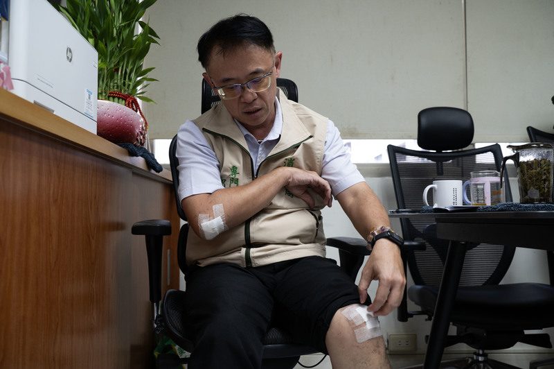 台南市消防局專委邱淵明在現場遭爆炸飛濺的鎂塊燒傷。（攝影／楊子磊）