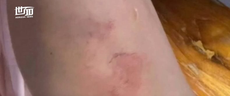 女子在被綁途中受傷。（新京報）