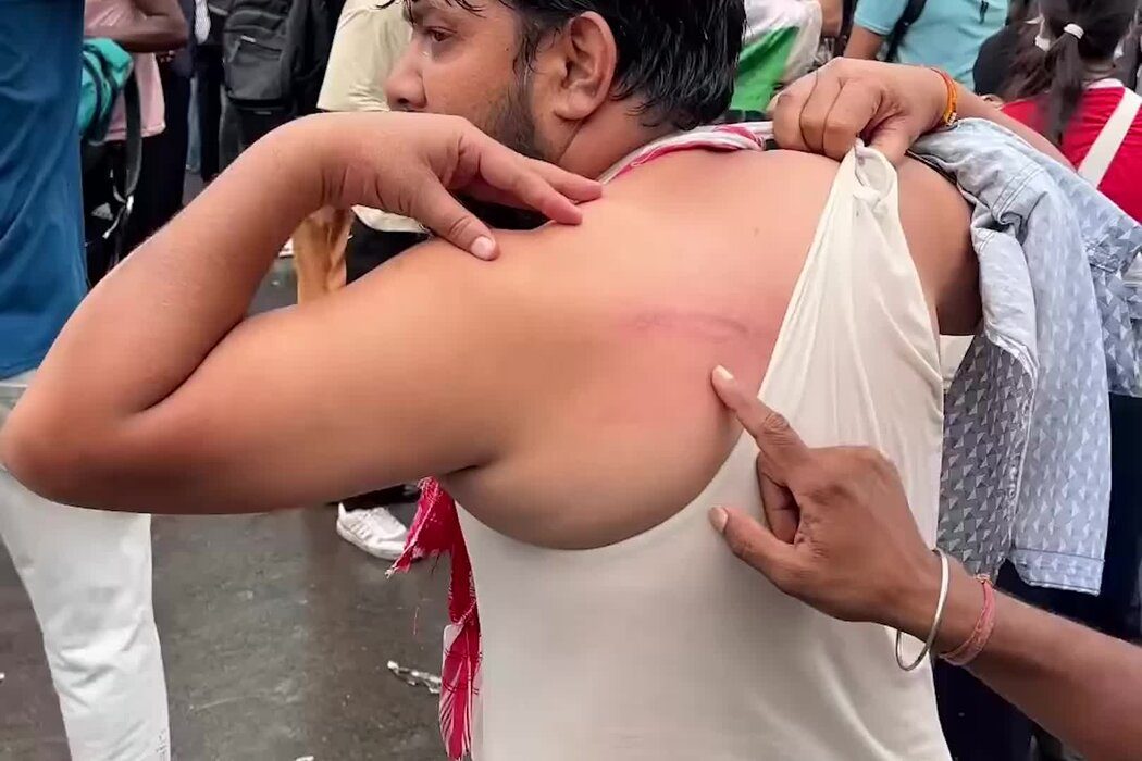 弹丸枪、警棍、催泪瓦斯:印度警方如何镇压青年抗议者 2 a732f647c7a31a70a4821d1af950a58f4c17d836a7e5a422156098089f27589d article