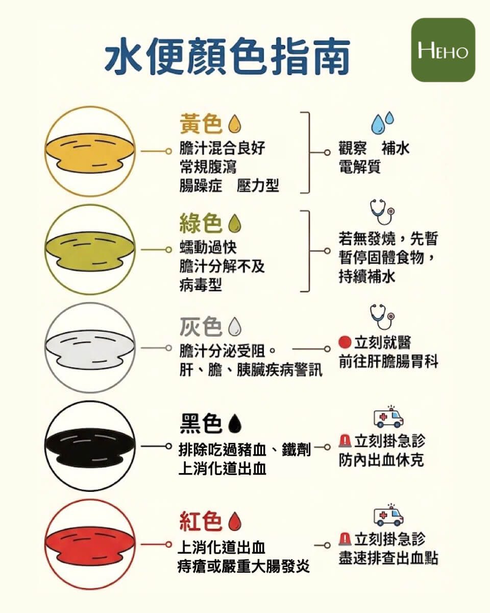大便都是水怎么办?先看肚子「痛不痛」!4 大原因与急救饮食一次看 1 糞便的顏色是腸胃發出的求救信號,5 種水便顏色,決定你要不要立刻掛急診!