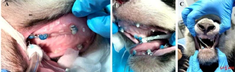 全球首例!成都歪脸大熊猫「戴牙套」 半年恢复健康不再漏奶 1 醫生在黏接矯治器後,為「北俠」套上3根正畸彈性橡皮圈,原理與人類戴<a href='/search/tagging/2/牙套' rel='牙套' data-rel='/2/262034' class='tag'><strong>牙套</strong></a>極為相似。圖/紅星新聞