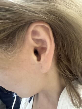 獨家 /八點檔女星遭家暴痛毆傷勢曝光！多處挫傷瘀青、耳內出血左手抬不起　忍痛單手駕車返北